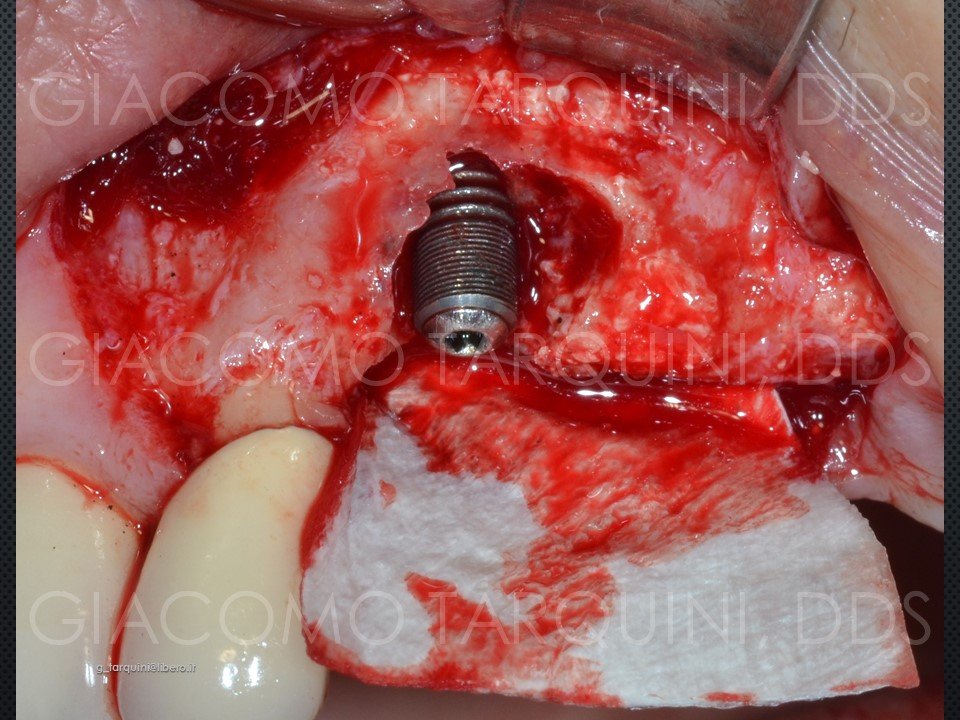 Diapositiva22.JPG.038fbaa9e109bf532b916407f0dcf4fb.JPG