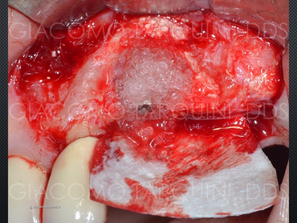 Diapositiva23.JPG.ade9dc28ddd9b479221072c1c708c57f.JPG