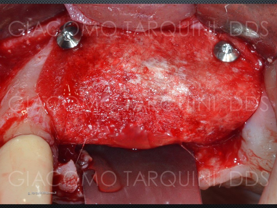 Diapositiva25.JPG.78e31f3e2a6e00299f7aed03f1fce136.JPG