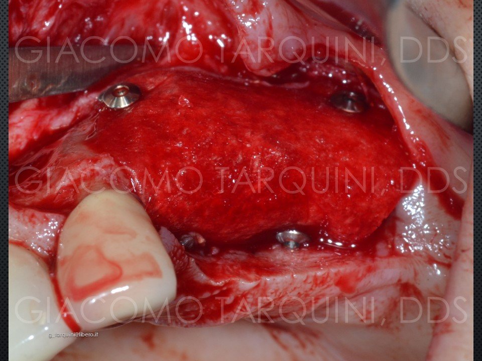 Diapositiva26.JPG.8f81dd42639a8fb240f8dde62bc4f392.JPG