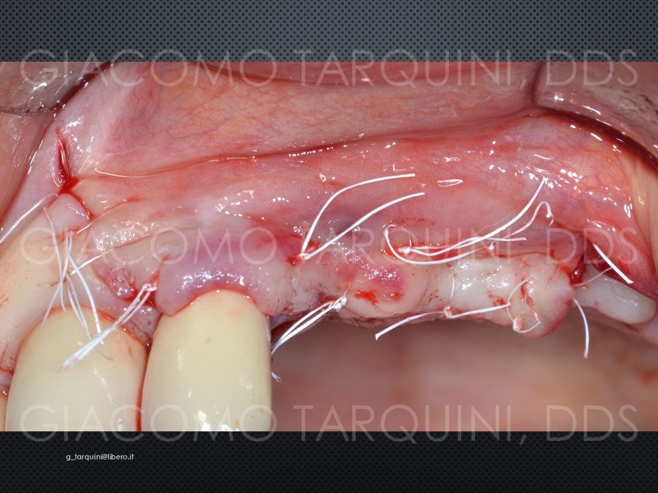 Diapositiva27.JPG.238ea93e8c3c4ddc82a69a9c2f06a4a7.JPG