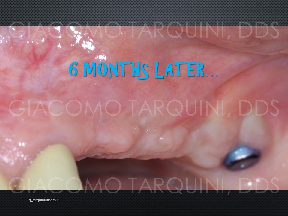 Diapositiva29.JPG.da0631e6b70ca4f3eb9234e7bc528231.JPG
