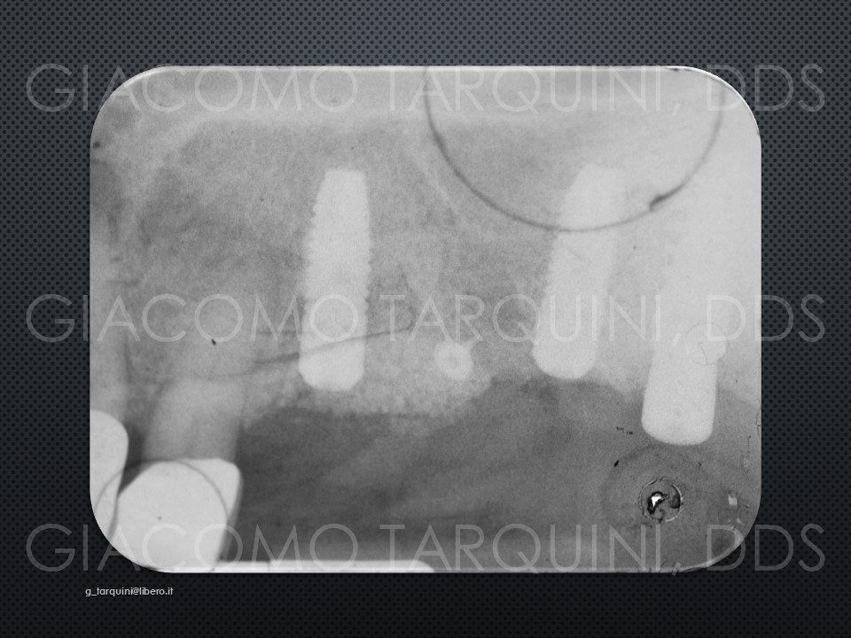 Diapositiva30.JPG.95461fc88d170c7ed025f74acf05c9bc.JPG