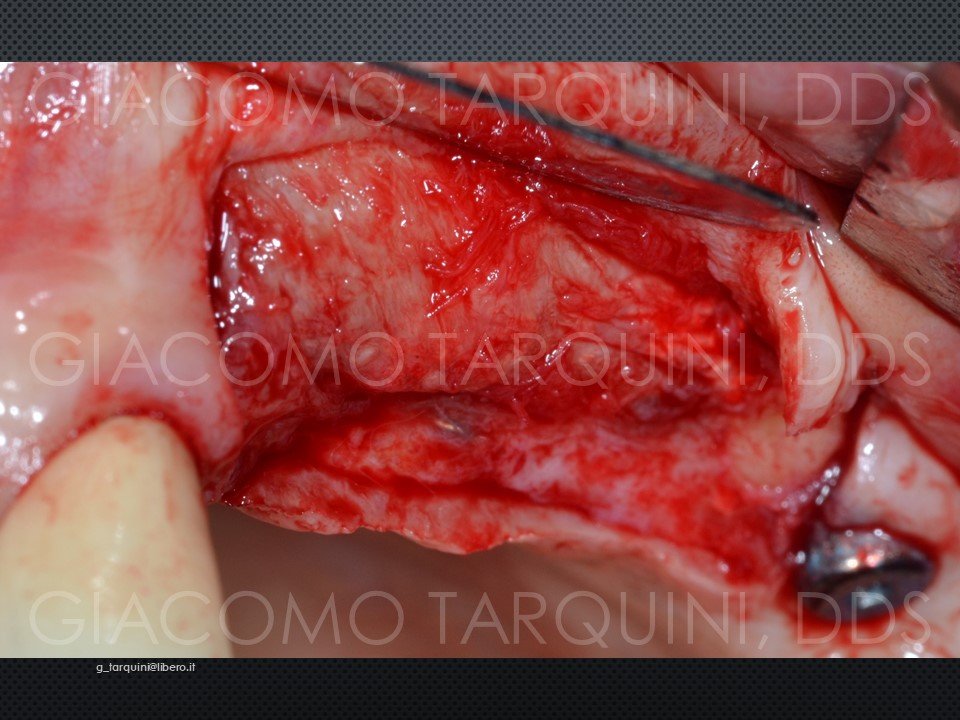 Diapositiva31.JPG.231bc822cb592bc39236308bc6b21c54.JPG