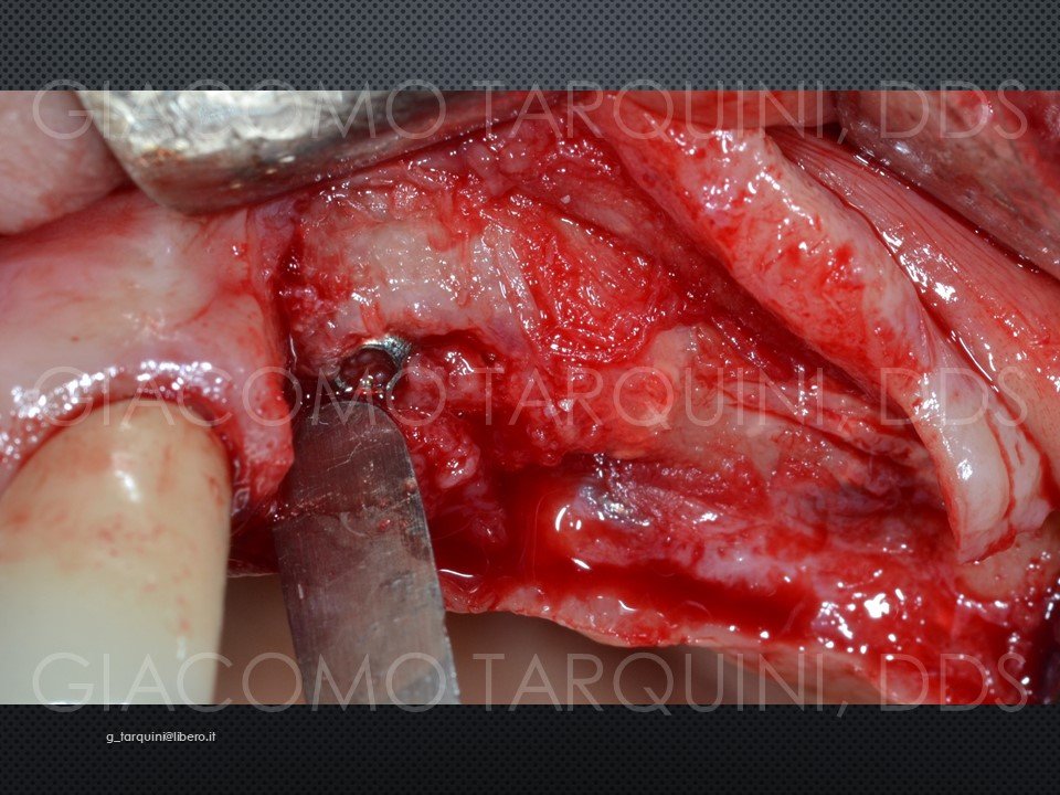 Diapositiva32.JPG.24bc8b8d1b1618d5eac2d4ea9cc40f33.JPG