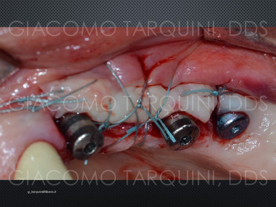 Diapositiva35.JPG.b91a881e9febbe2aec21ad99870235c6.JPG