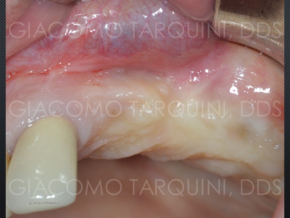 Diapositiva5.JPG.6e1621eaa5cb40e0741ffca73fb04cf8.JPG