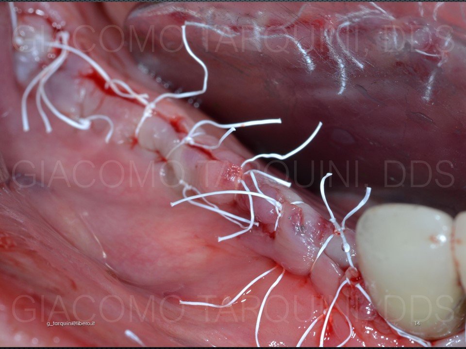 Diapositiva14.JPG.a1809101f14dc16519eae3cde4d40aa2.JPG