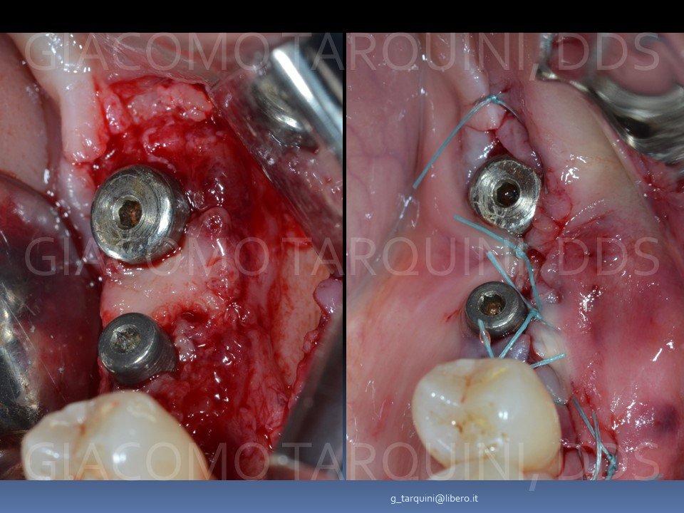 Diapositiva23.JPG.3d0dac07e390fadb7ea30ffea50c9f3e.JPG