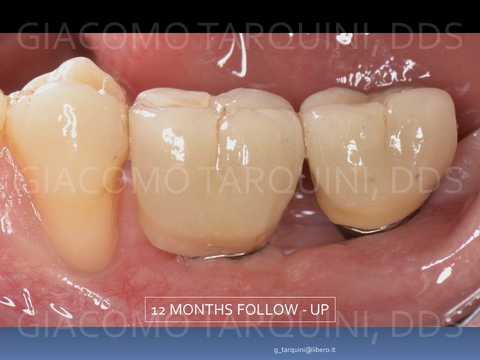 Diapositiva24.JPG.ef75d54a27a1e43b9449183f71223c5f.JPG