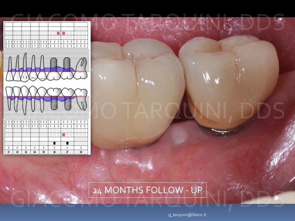 Diapositiva25.JPG.e8deae8c99302303a8dbb374550f660c.JPG