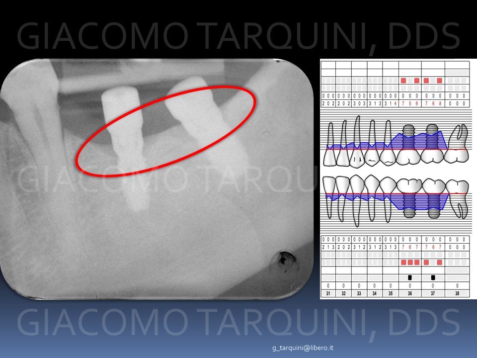 Diapositiva5.JPG.167ddc1f56b22b97139afffe9d4c7daf.JPG