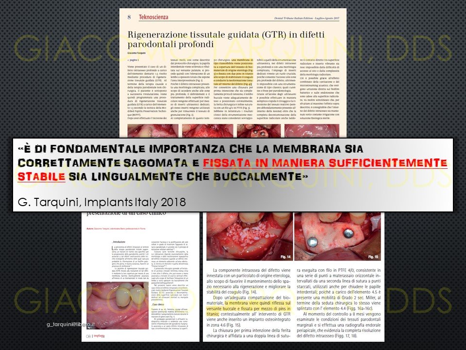 Diapositiva18.JPG.c5a1b3ce9b096ac6fc5e5d88d265031c.JPG