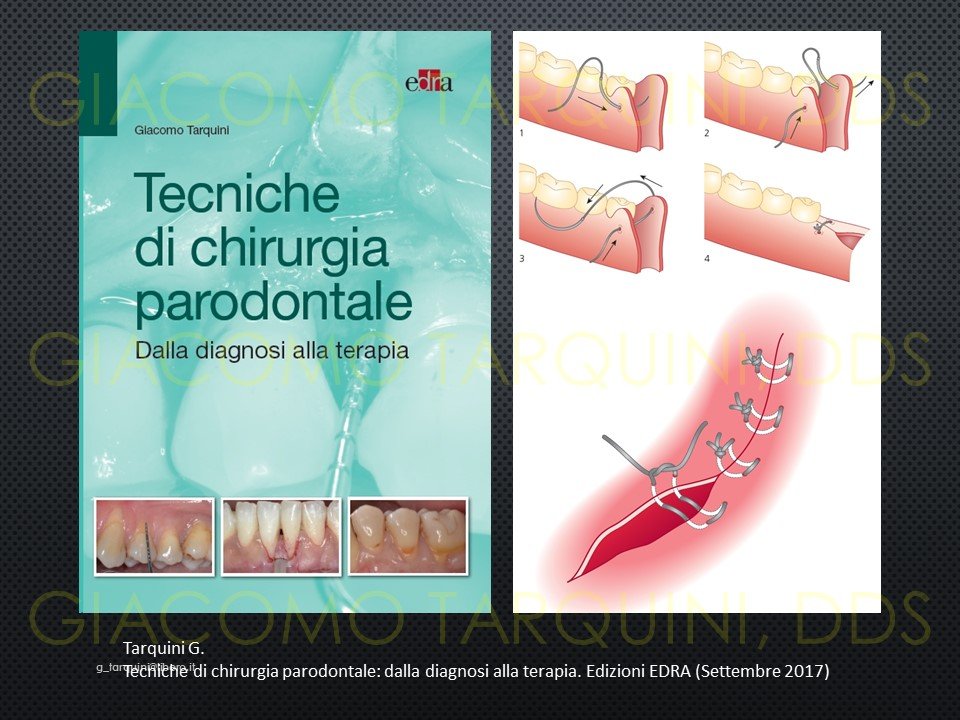 Diapositiva20.JPG.8cdc5fd78e50d81cc72fe0ea443b326a.JPG