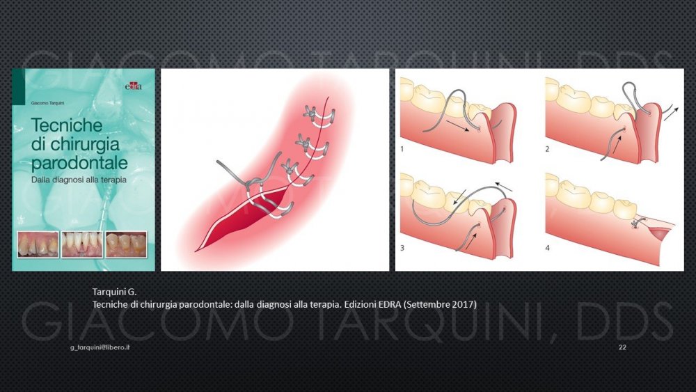 Diapositiva22.thumb.JPG.475cb25382c538a522865c6c4a2b8415.JPG