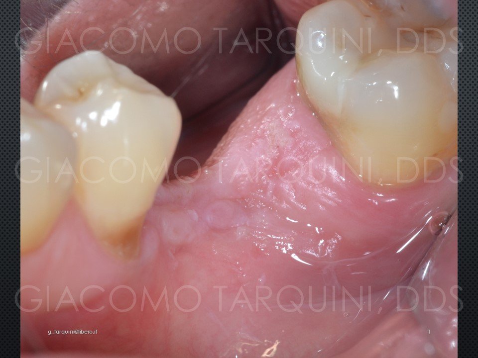Diapositiva1.JPG.87aeed8ed6a5c14780759115b81ca4e1.JPG