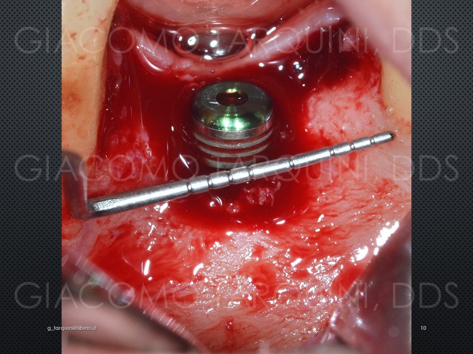 Diapositiva10.JPG.9a306cb0376803abdc94a96311bce28d.JPG