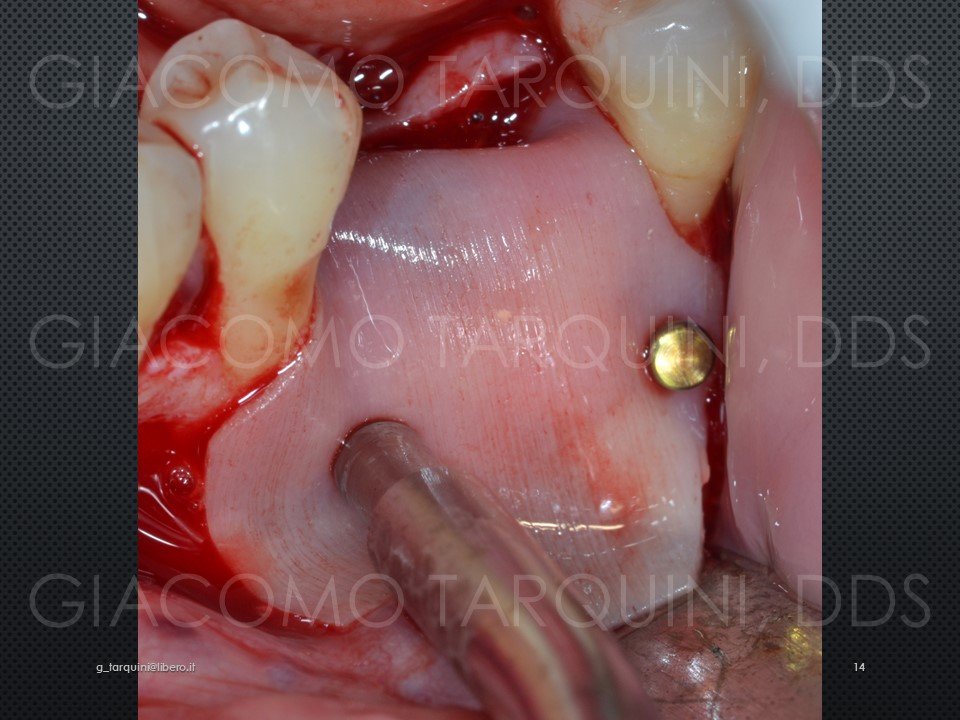 Diapositiva14.JPG.662859d049d7914fbfc9692ecba29b4b.JPG