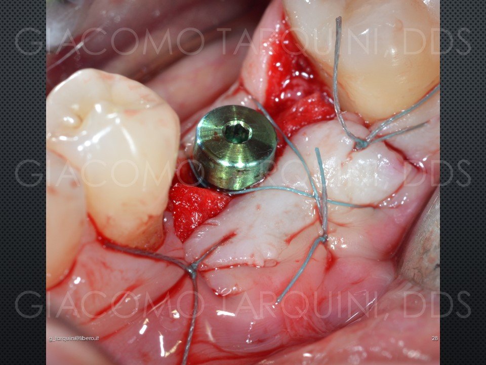Diapositiva28.JPG.8bae6482a49e78104b5a5c1ea7be728d.JPG