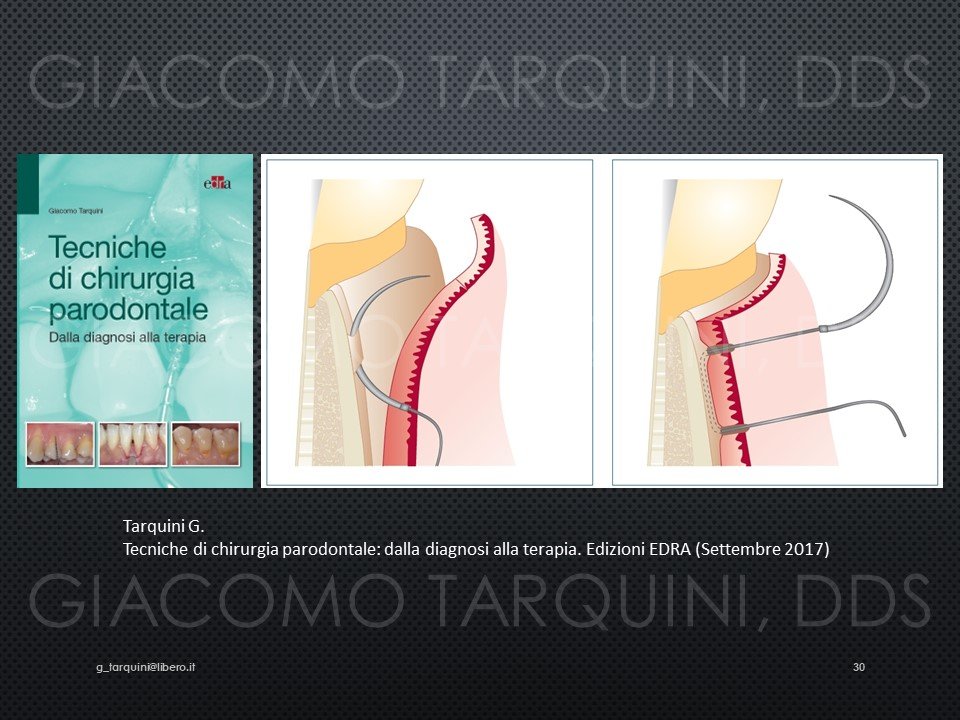 Diapositiva30.JPG.e9aa9c5d7a0ceb4669fb110683d73af7.JPG