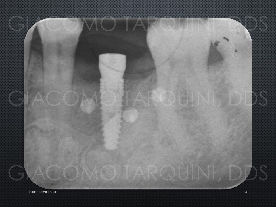 Diapositiva31.JPG.3d512b4d651d5c310985e5330fbe6890.JPG