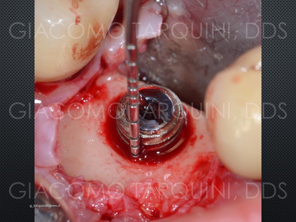 Diapositiva13.JPG.32837c77e9e67a5a9271438faebd32f9.JPG