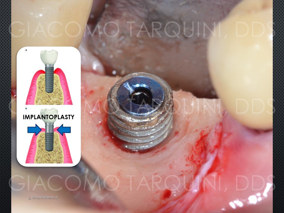 Diapositiva18.JPG.9894bba591924483a3c6ecf53f08e71a.JPG
