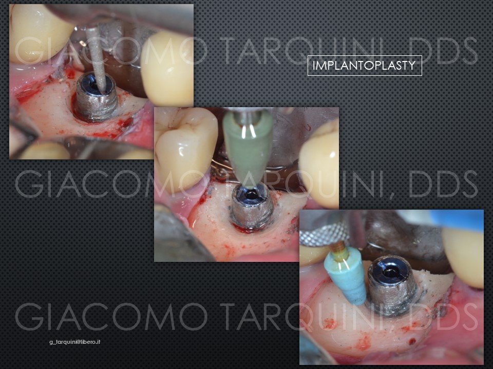 Diapositiva19.JPG.eaecca44505971a06b7f47fc0d13103c.JPG