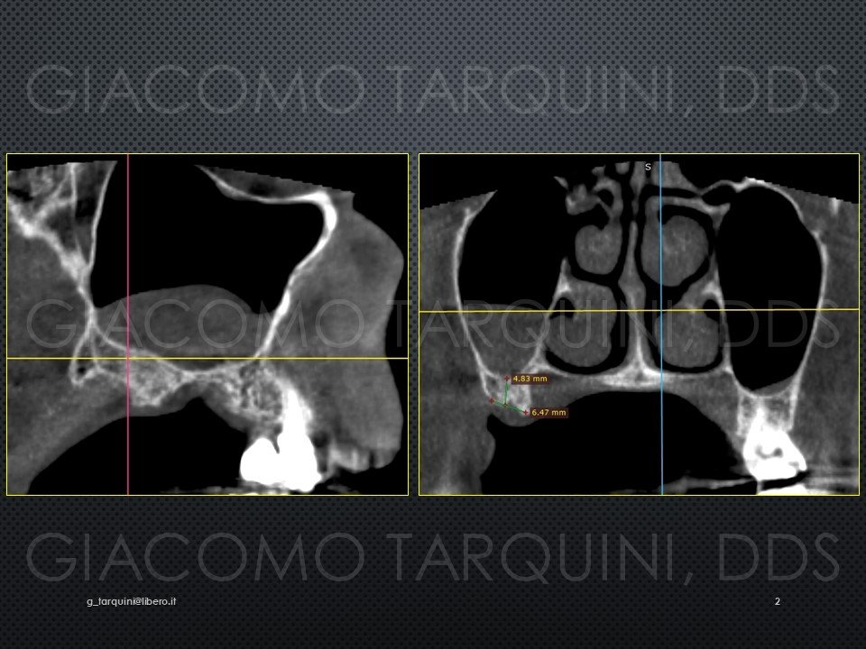 Diapositiva2.JPG.1886f041ba273a379eec51f071d39570.JPG