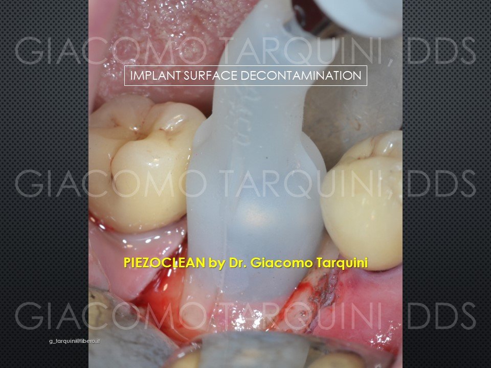 Diapositiva22.JPG.b2f61bd943f29ab23ba74e17d6c747da.JPG