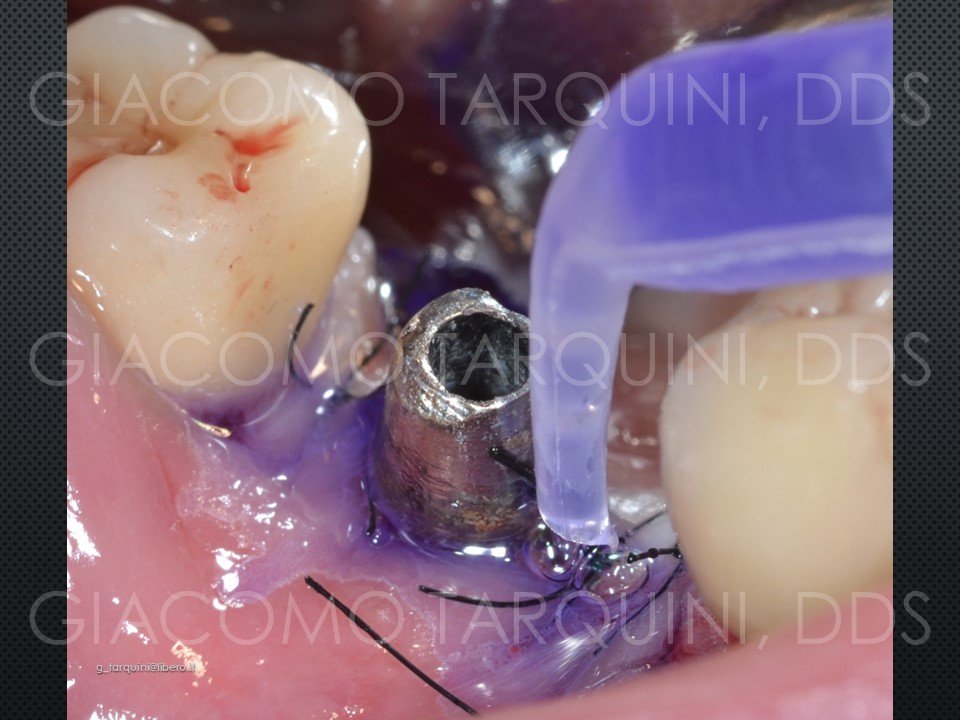 Diapositiva25.JPG.ca3be90efcdcd767fb3c6194ded8f52b.JPG