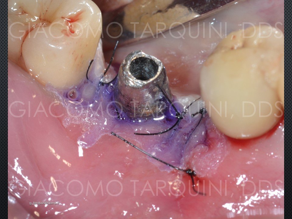 Diapositiva26.JPG.5ab96016f622b00d4d4f9ae050e288ba.JPG