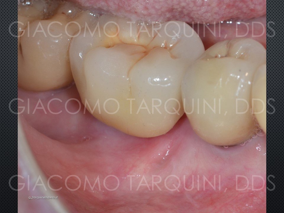 Diapositiva30.JPG.ef34c38e810ab0d846bb49d05c1ec642.JPG