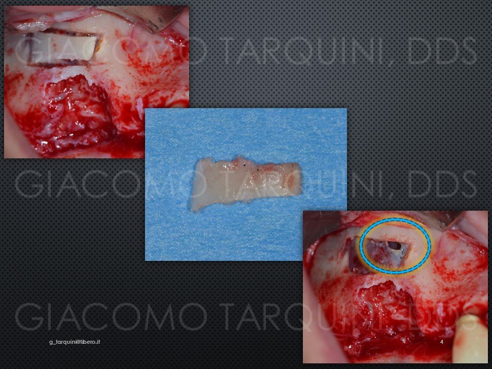 Diapositiva4.JPG.d8f84b1dc2609ff28a11900c3c6b985e.JPG