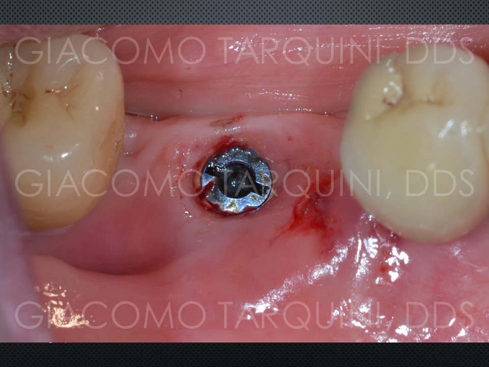 Diapositiva8.JPG.d59f1cc23ada059f8ad868128d73d324.JPG