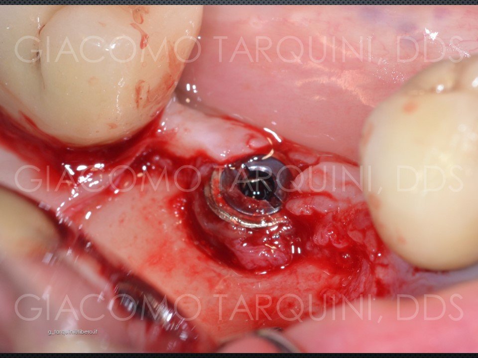 Diapositiva9.JPG.613277566ab739bc39e9bfd4b083a3ba.JPG