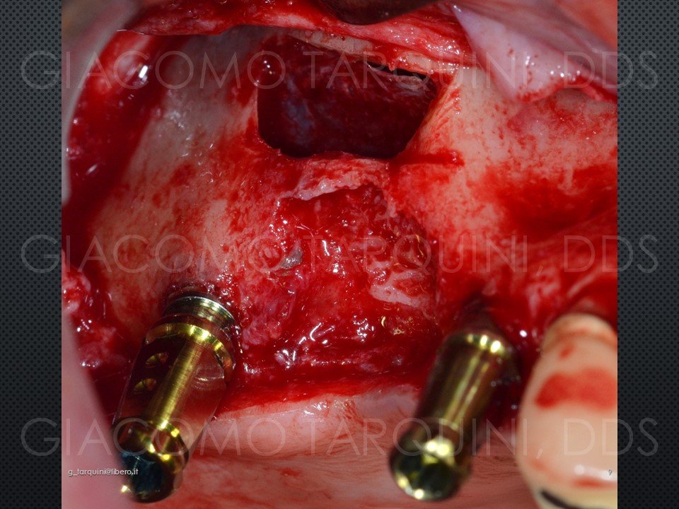 Diapositiva9.JPG.663886436546006008b7ddec5a2be8a6.JPG