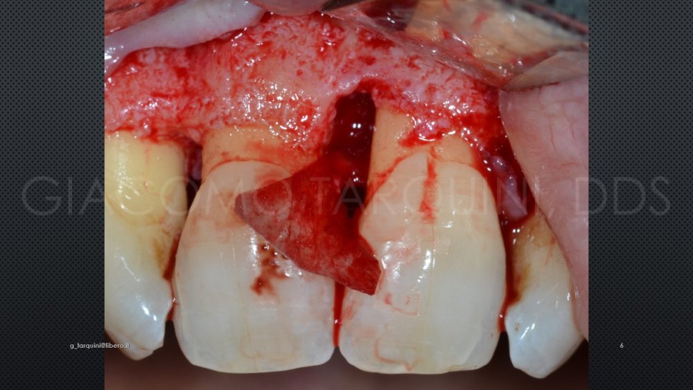 Diapositiva6.thumb.JPG.442a9a0ac93c763b98170e16b6c6fed5.JPG