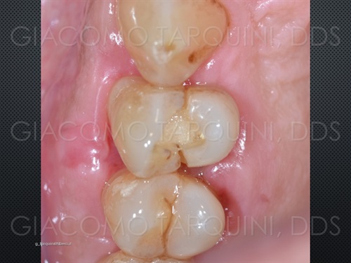 Diapositiva1_030101318_mid.jpg.f8abfab17614ee3ebadcc226262dde8d.jpg