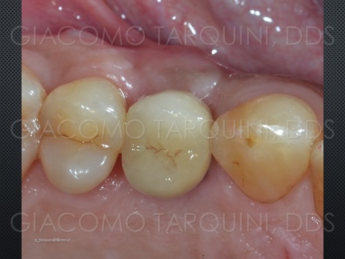 Diapositiva25_030101146_mid.jpg.c2a2625d05d3be401a8ff91e84f2bbbe.jpg