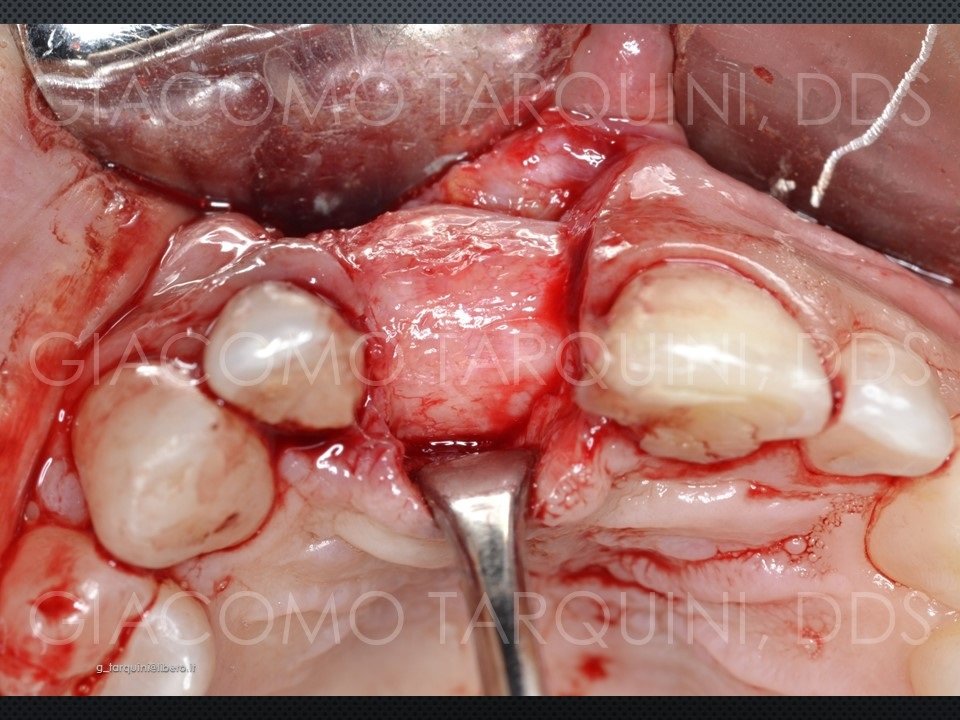 Diapositiva23_140926189.jpg.1f200c21e49748cb6ead7341b54d3ac7.jpg