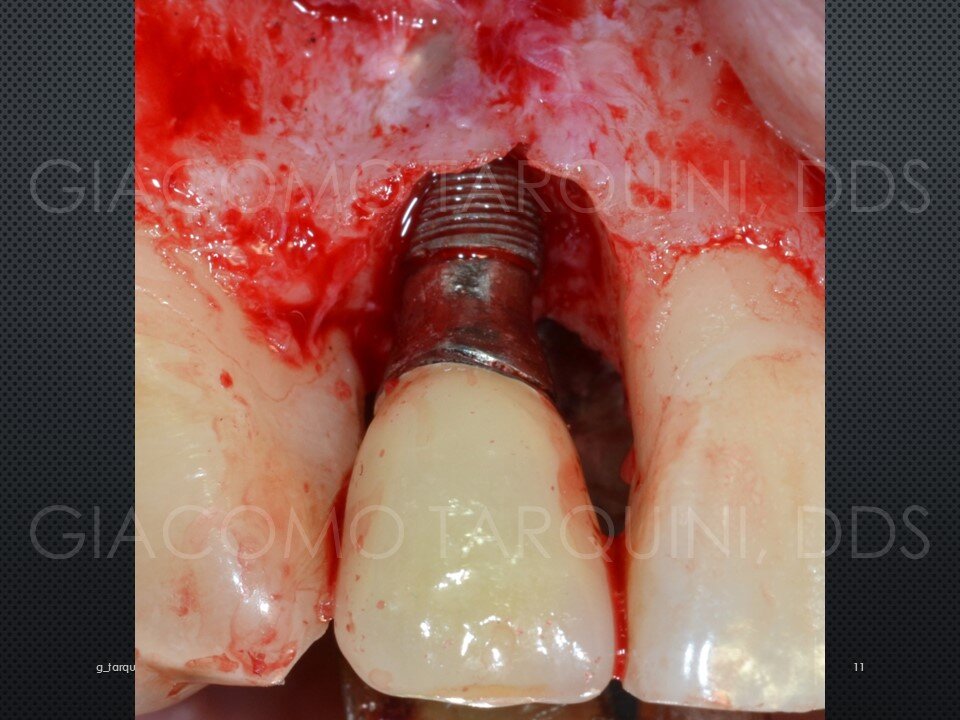 Diapositiva12.JPG.0b66a01ca7eade630bf4ac6a056f5173.JPG