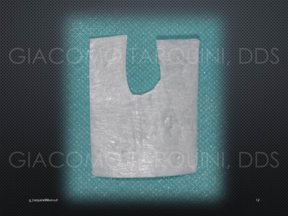 Diapositiva13.JPG.d0bcac5ce51445b42fa02a5e30ac11c4.JPG