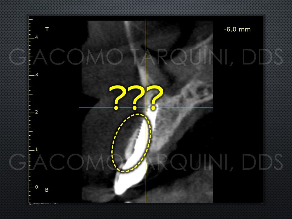 Diapositiva2.JPG.538acbd2aea1a6f0d9d9a5ba0f80cf8c.JPG