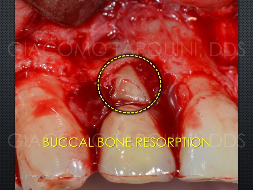 Diapositiva4.JPG.afc1896589ee8c2da7d324c22402e1c2.JPG