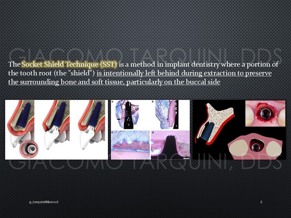 Diapositiva5.JPG.e1bc2b3f15a5650d132753ddb3096f66.JPG
