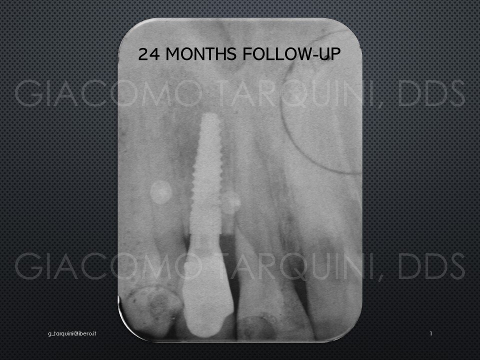 XRAY.jpg.d08f219d1b3aa17e5a2e858c17224beb.jpg