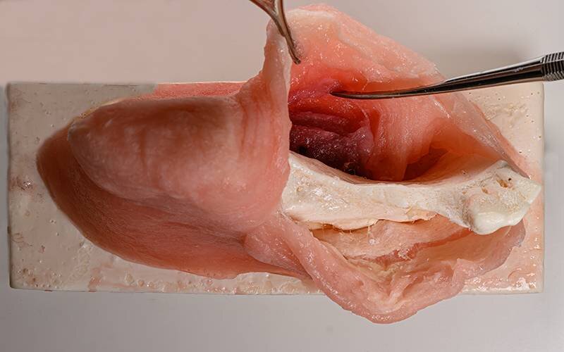 Corso Pratico di Lembi E Suture in Chirurgia Orale E Implantare I Ed. 2026