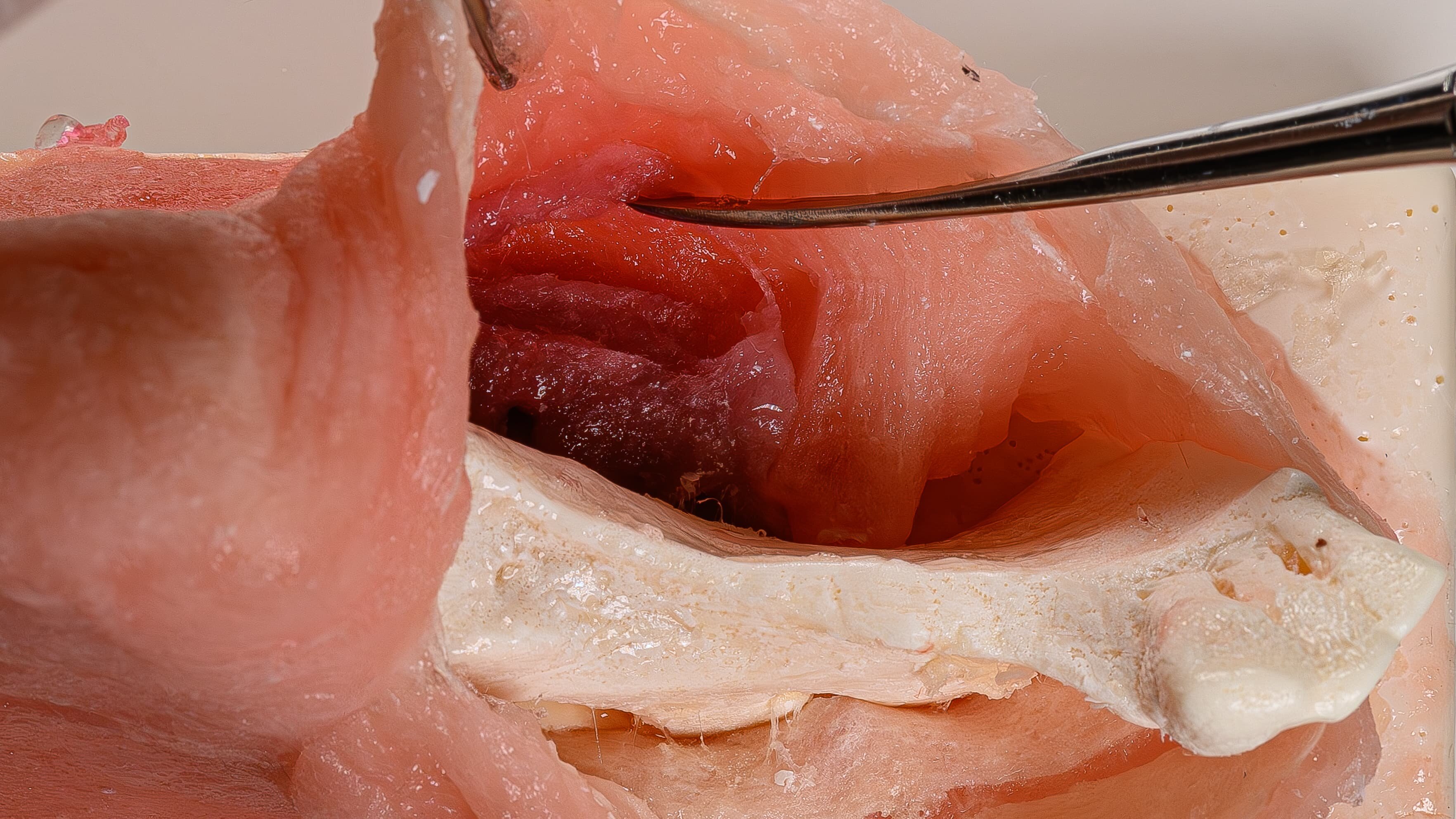 Corso Pratico di Lembi E Suture in Chirurgia Orale E Implantare II Ed. 2026