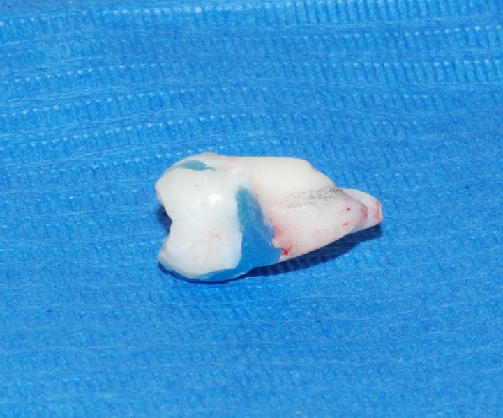 post-109-13493414921_thumb.jpg